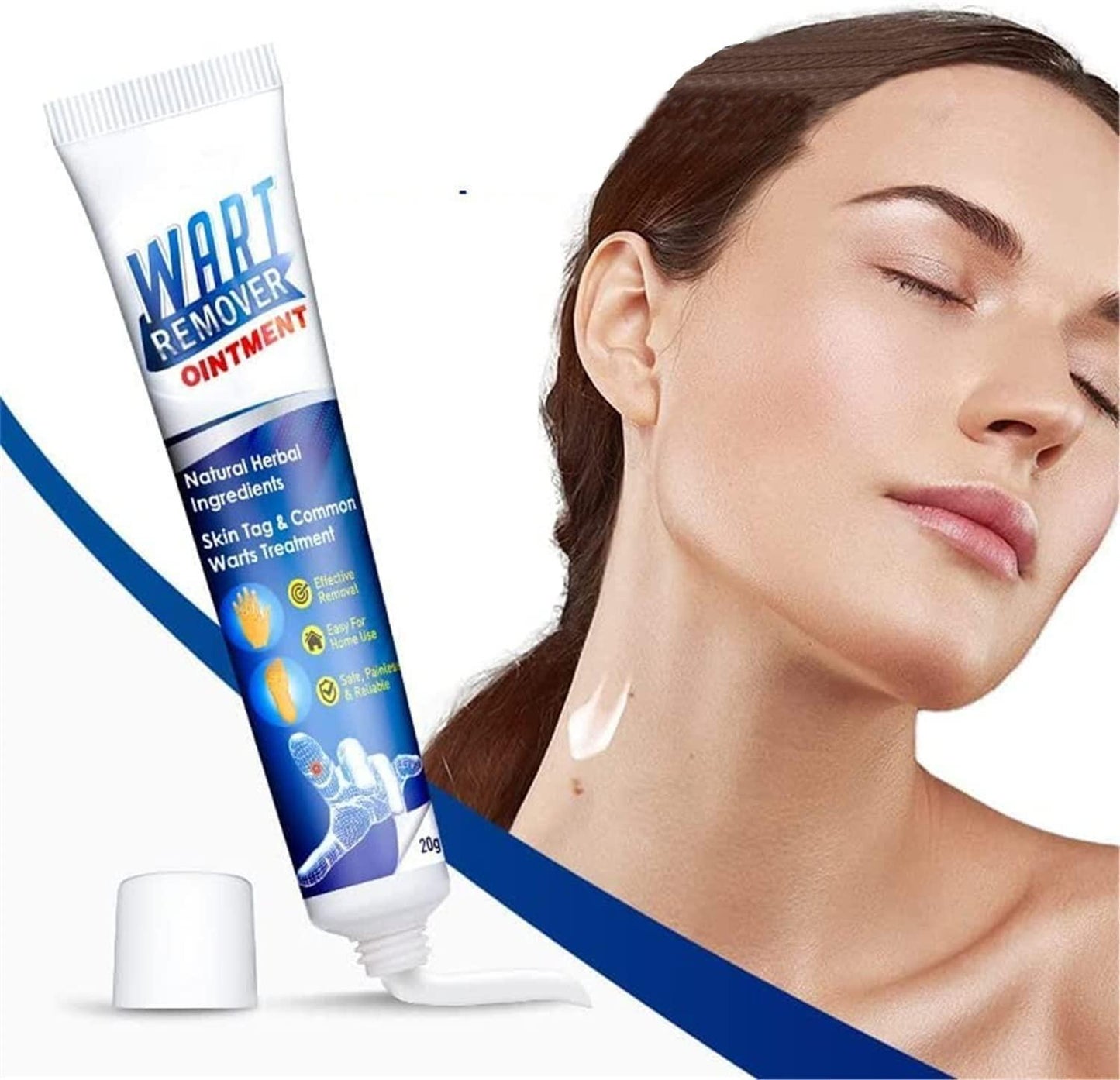 WartsOff Instant Blemish Removal Cream Pack of 2 - TRENZY CART