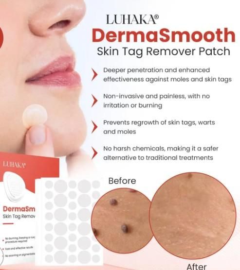 Skin Tag Remover Patch - TRENZY CART